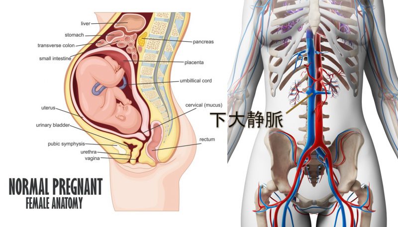 妊娠末期の子宮内と下大静脈の図